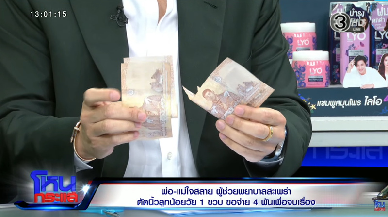 ผู้ช่วยพยาบาลตัดนิ้วลูกขาด