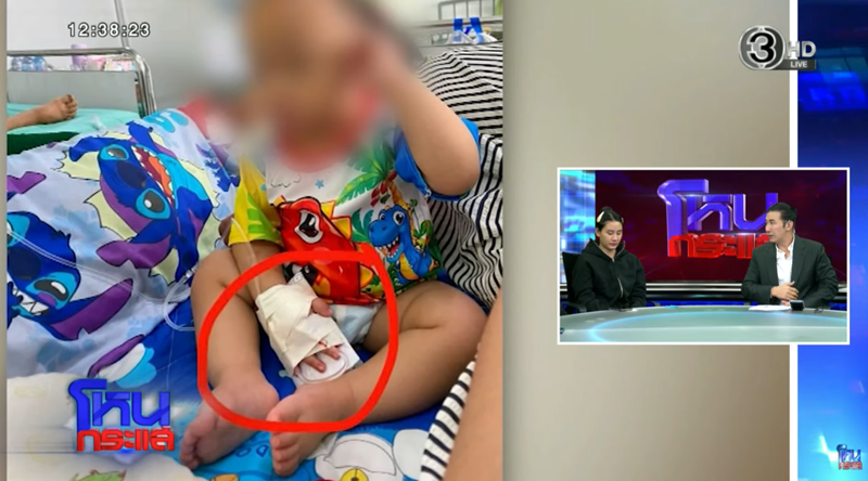 ผู้ช่วยพยาบาลตัดนิ้วลูกขาด