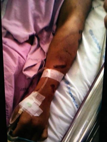 ทหารโดนซ้อม