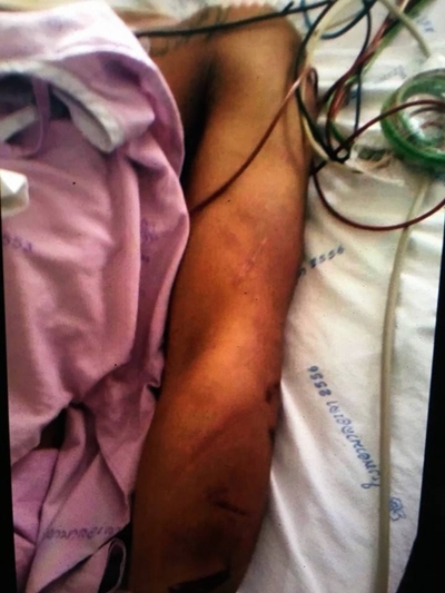 ทหารโดนซ้อม