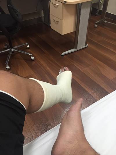 โดนตัดขา