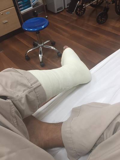 โดนตัดขา