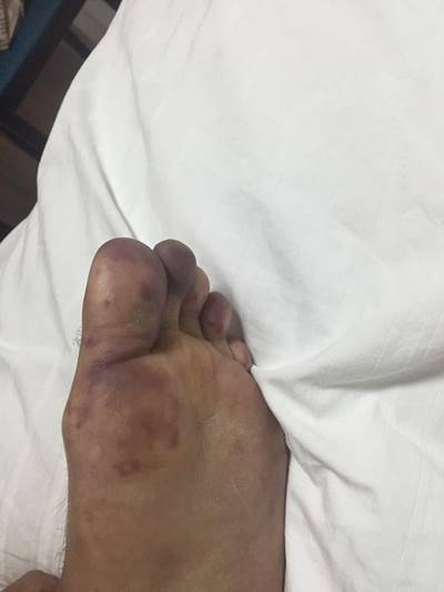 โดนตัดขา