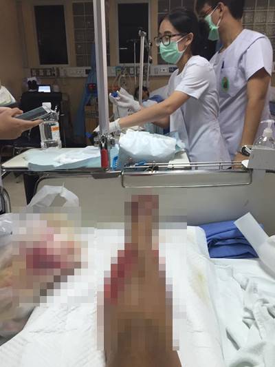 โดนตัดขา