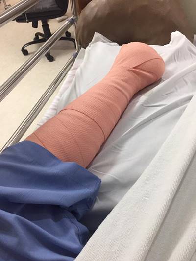 โดนตัดขา