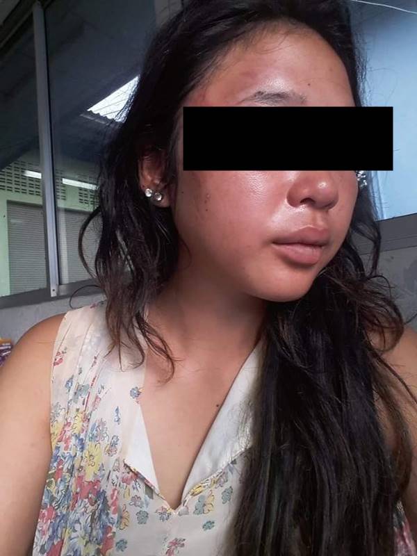 ทำร้ายคนท้อง