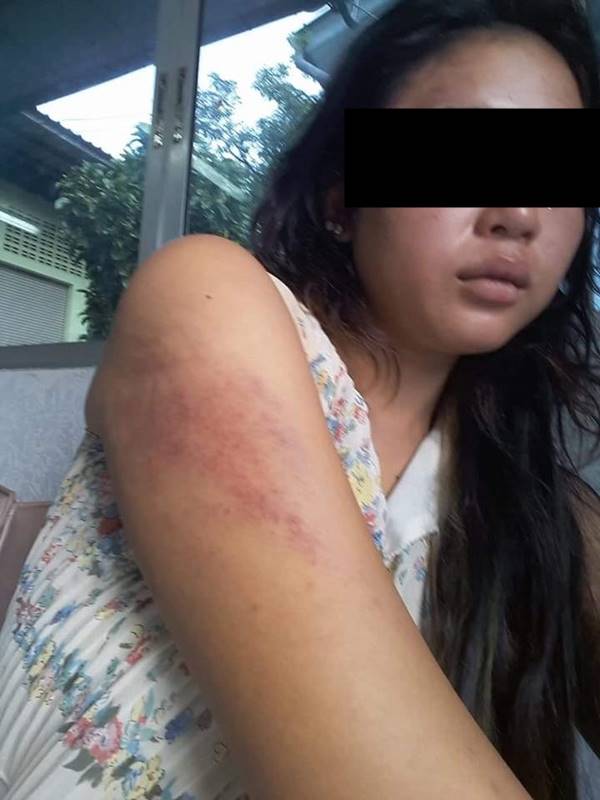 ทำร้ายคนท้อง