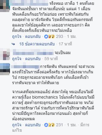 จัดฟันแฟชั่น