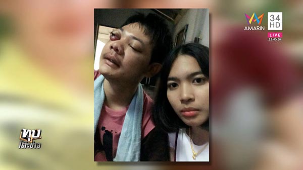 ป่วยมะเร็งใบหน้า