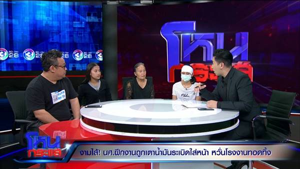 เตาสารเคมีระเบิดใส่หน้า