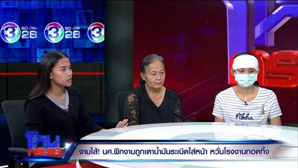 เตาสารเคมีระเบิดใส่หน้า