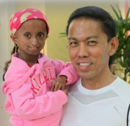 โรคแก่ก่อนวัย