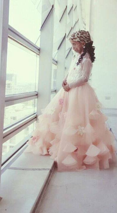 โรคแก่ก่อนวัย