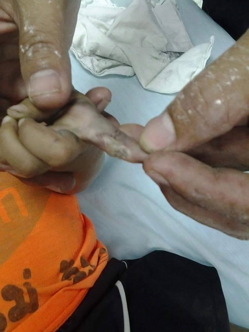 เด็กถูกไฟช็อต