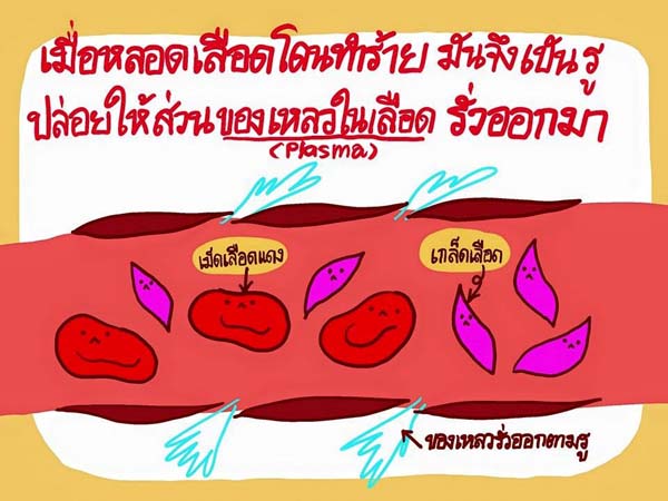 การ์ตูนโรคไข้เลือดออก