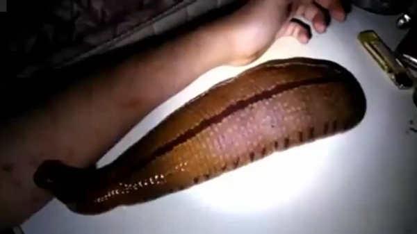 โหดจริง ! หนุ่มเลี้ยงปลิงเป็นเพื่อน หิวเมื่อไหร่ก็ให้ดูดเลือด ตัวโตเท่าแขนแล้ว