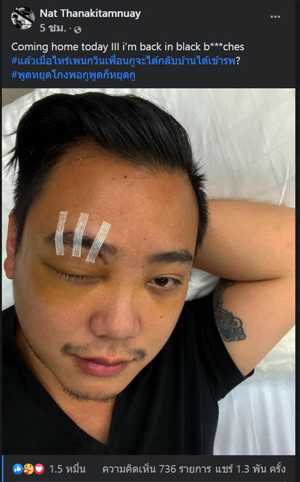 ไฮโซลูกนัทตาบอด