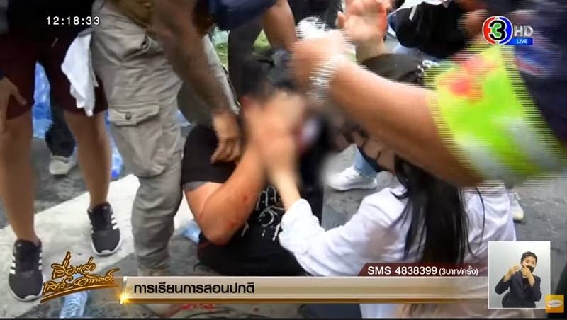 ไฮโซลูกนัทตาบอด