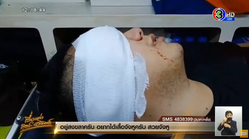 ไฮโซลูกนัทตาบอด