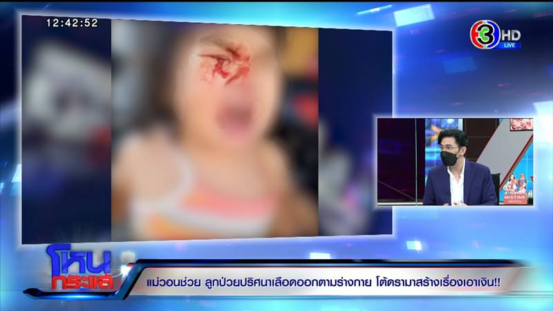 พ่อแม่วอนช่วย ลูกเป็นโรคเหงื่อออกเป็นเลือด