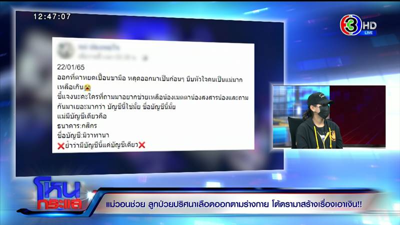 พ่อแม่วอนช่วย ลูกเป็นโรคเหงื่อออกเป็นเลือด