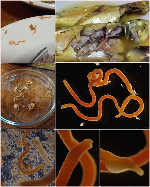 พยาธิสีส้ม