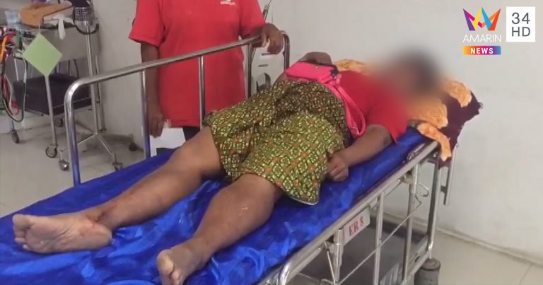 โดนเหล็กแทงอวัยวะเพศ