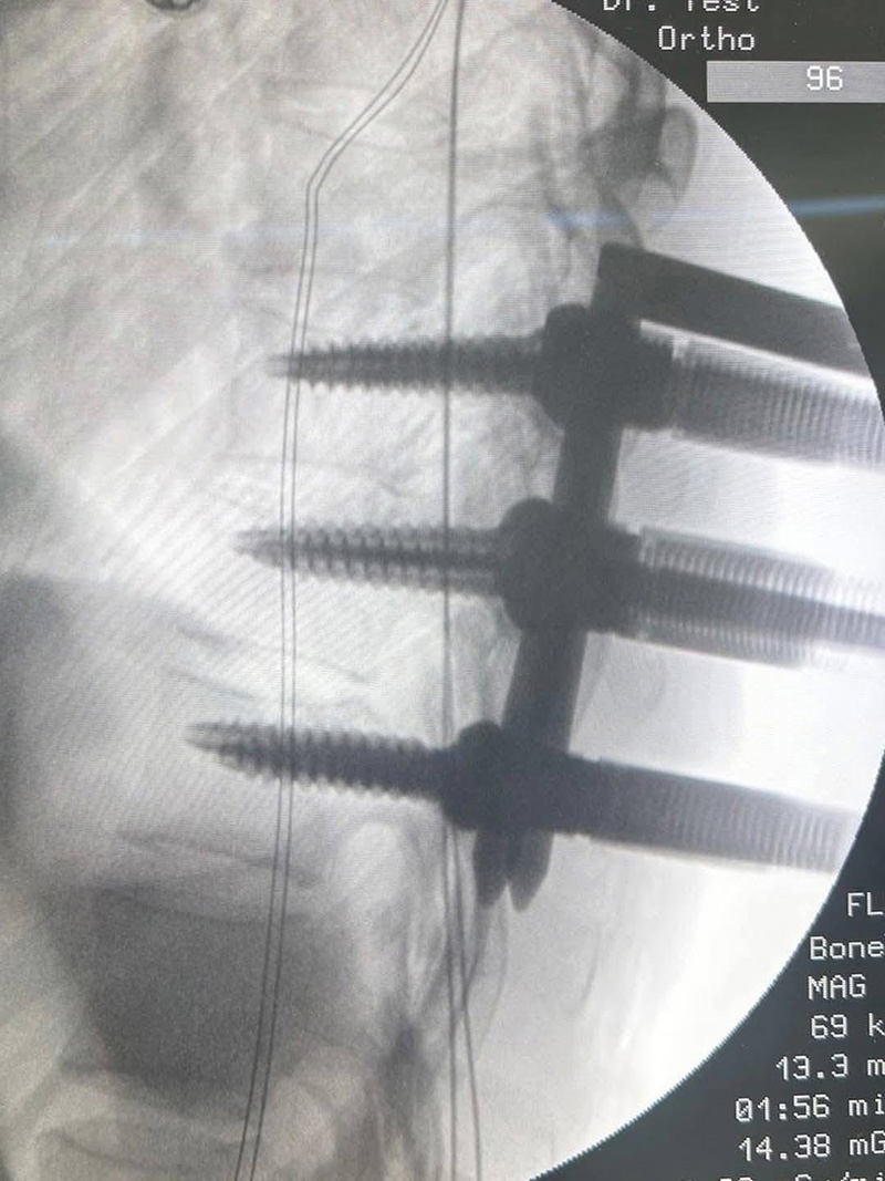 หมอโดนรถชน