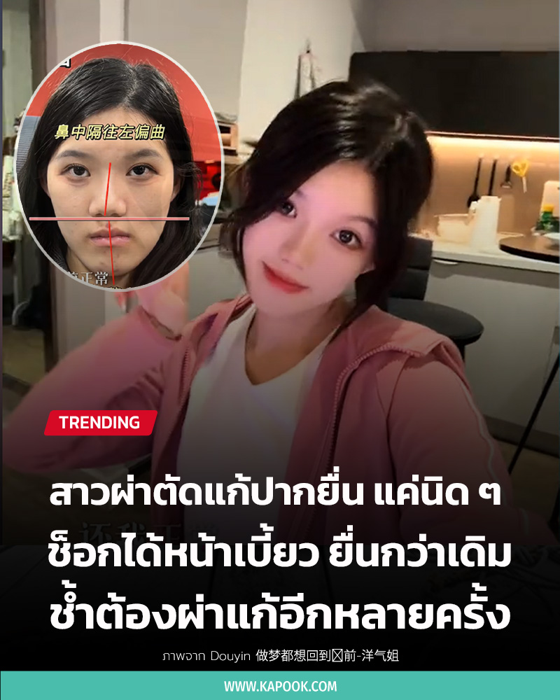 ศัลยกรรมผิดพลาด