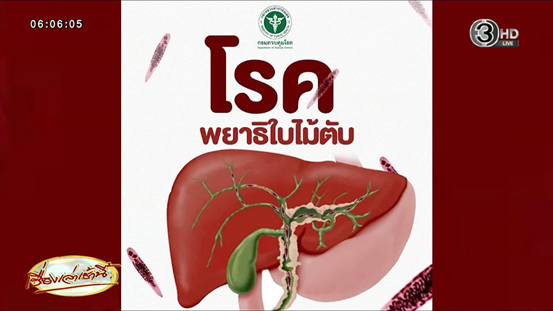 พยาธิใบไม้ในตับ