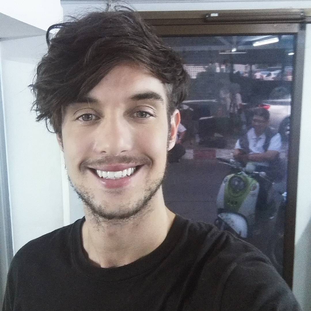 ซันนี่ เบิร์น