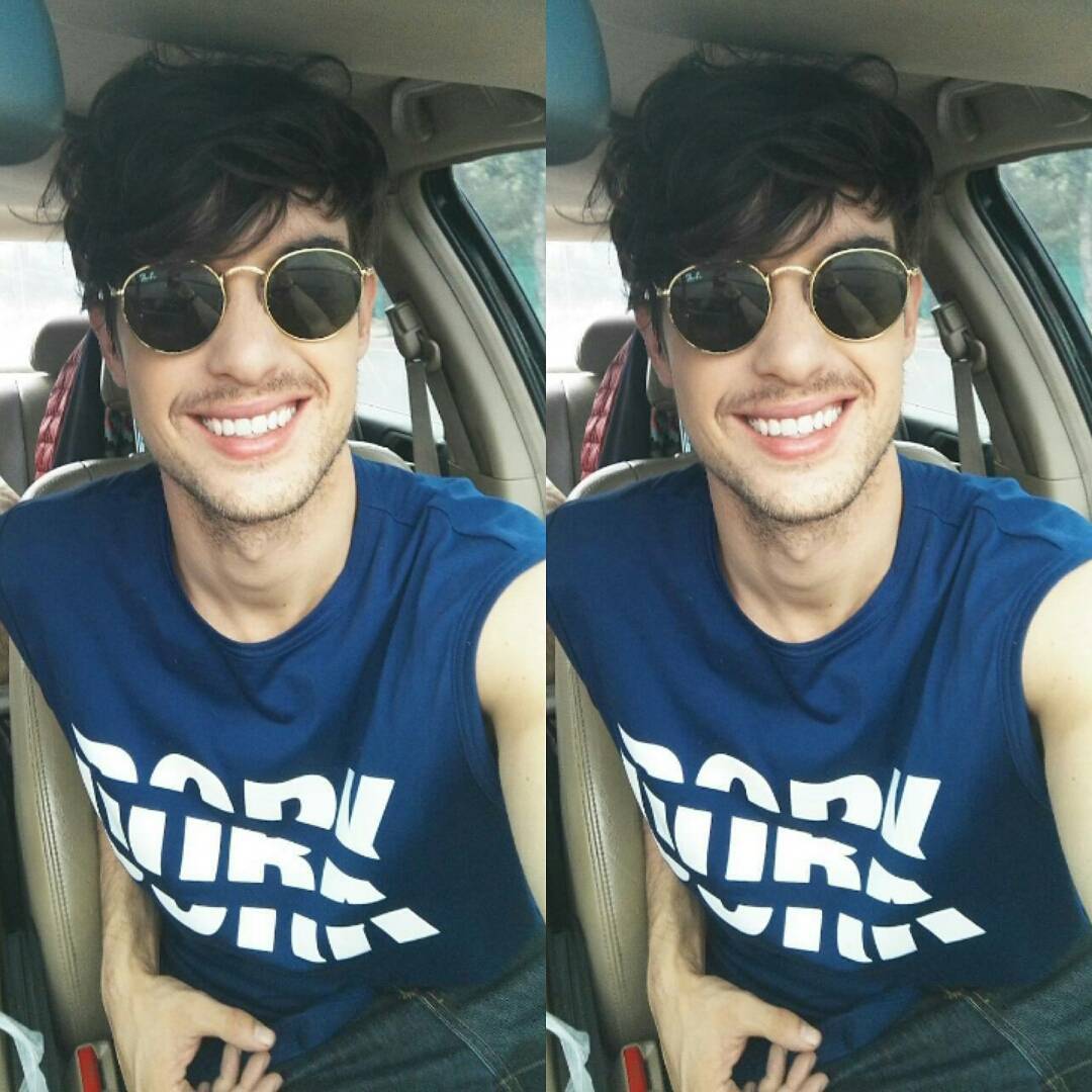 ซันนี่ เบิร์น