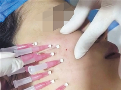 โรงเรียนสอนศัลยกรรมเถื่อน