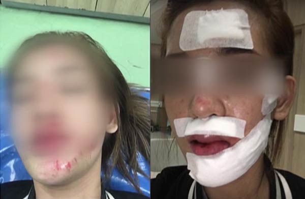 หนุ่มกระโดดเกาะหน้ารถชนแล้วหนี