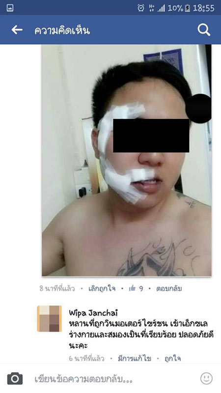 เจ้าของร้านค้าถูกวินมอเตอร์ไซค์ตะลุมบอน หลังวินขับรถเฉี่ยวลูกสาวเจ็บ