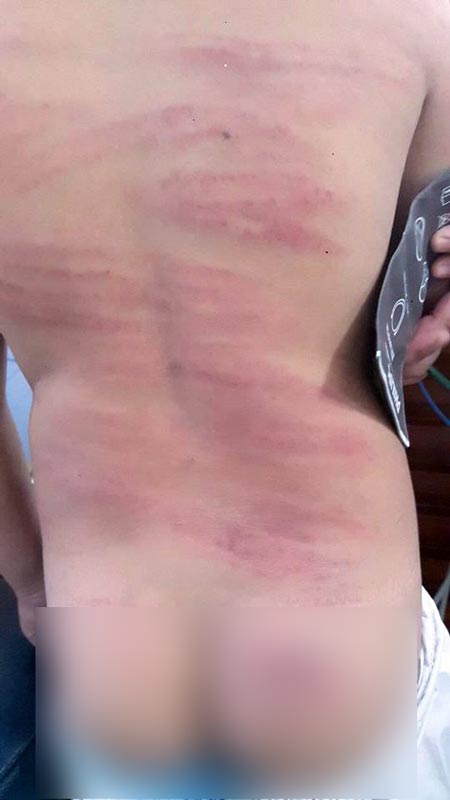 ครูใช้ไม้พลองตีเด็ก