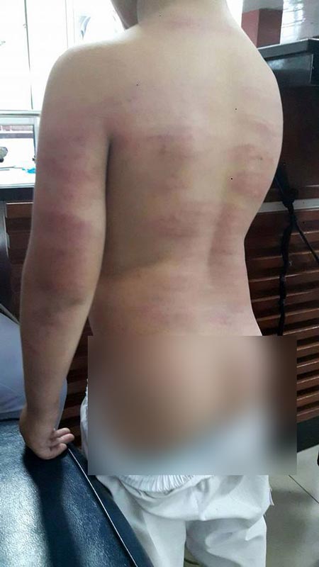 ครูใช้ไม้พลองตีเด็ก