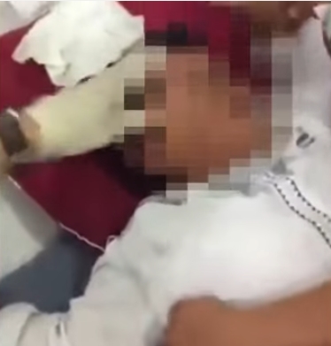 ขลิบสยอง อวัยวะเพศขาดครึ่ง