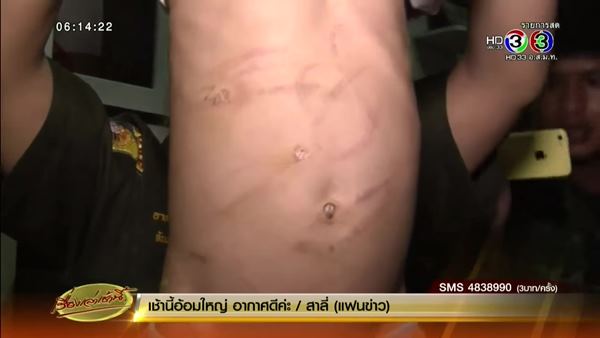 ด.ญ. 4 ขวบ ถูกแม่ทำร้าย ขังไว้ในบ้าน