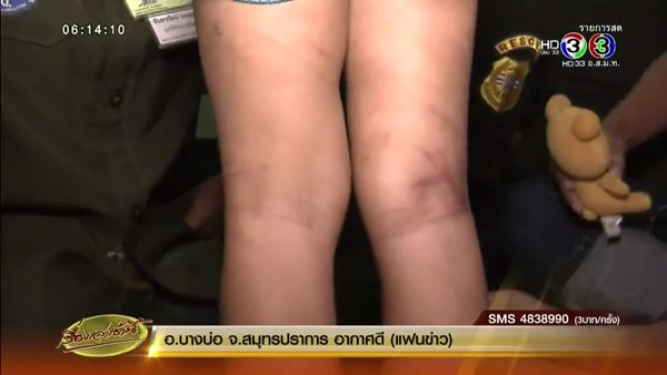 ด.ญ. 4 ขวบ ถูกแม่ทำร้าย ขังไว้ในบ้าน