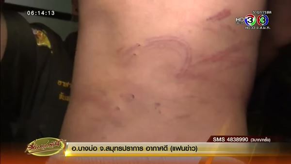 ด.ญ. 4 ขวบ ถูกแม่ทำร้าย ขังไว้ในบ้าน