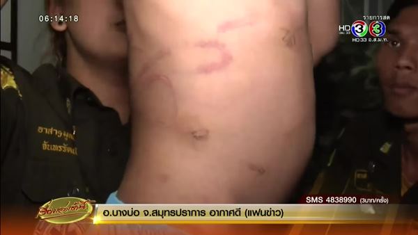 ด.ญ. 4 ขวบ ถูกแม่ทำร้าย ขังไว้ในบ้าน