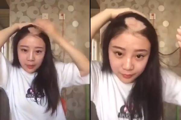 สาวลองกินข้าวโพดแบบคลิปดัง ฟันไม่หลุด แต่ผมร่วงเป็นแถบ