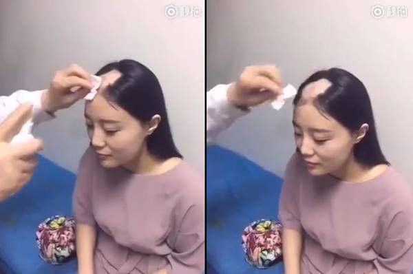 สาวลองกินข้าวโพดแบบคลิปดัง ฟันไม่หลุด แต่ผมร่วงเป็นแถบ