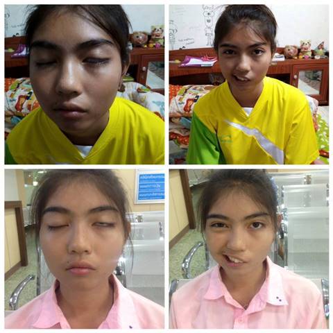 ครูพละปาแก้วใส่นักเรียนจนปากเบี้ยว
