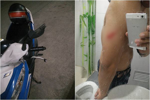 เตือนภัย ซอยไส้แตก ย่านคลองหก