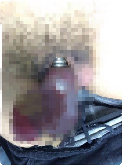 ห่วงรัดโคนรัดอวัยวะเพศ