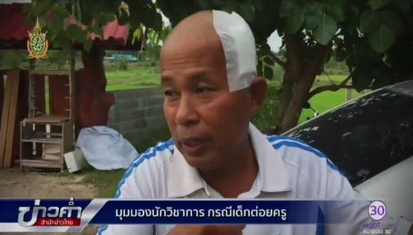 เด็ก ม.1 ต่อยรอง ผอ. จนเลือดคั่งในสมอง