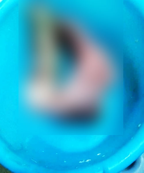 ร้านอาหารจีนเสิร์ฟอุ้งตีนหมีให้ลูกค้า แต่แท้จริงแล้วมันคือเท้าของมนุษย์