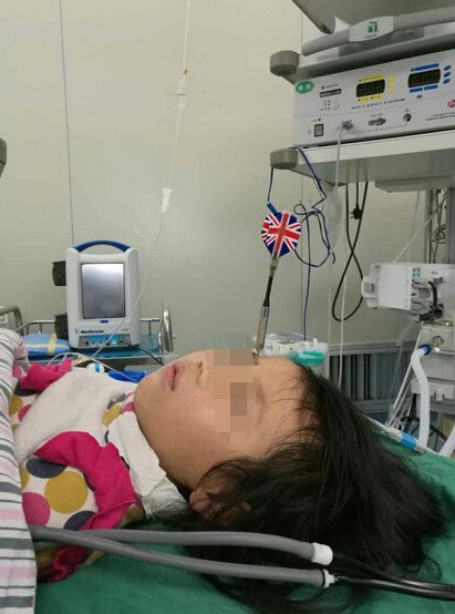 พี่ชาย 7 ขวบ ปาลูกดอกปักหว่างคิ้วน้อง 6 ขวบ